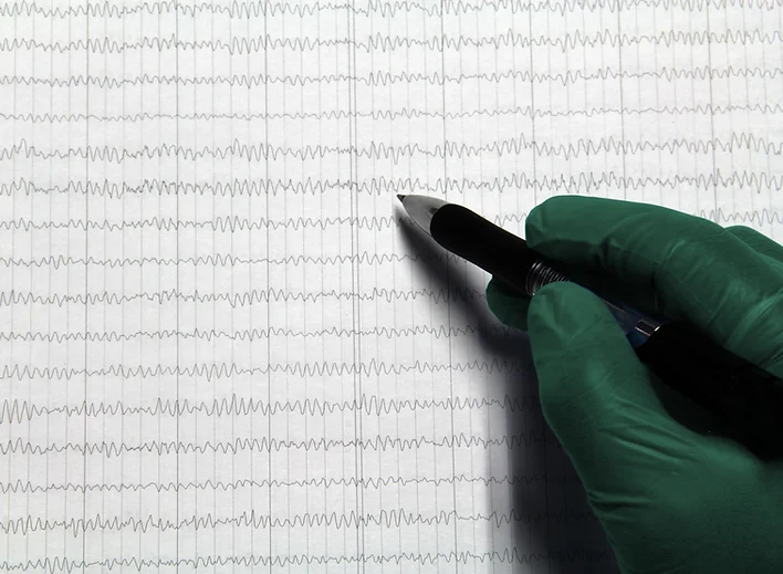 What are the Benefits of Brain - 11062b 60730bcacc984a3d8abfc7df77249f01mv2.webp